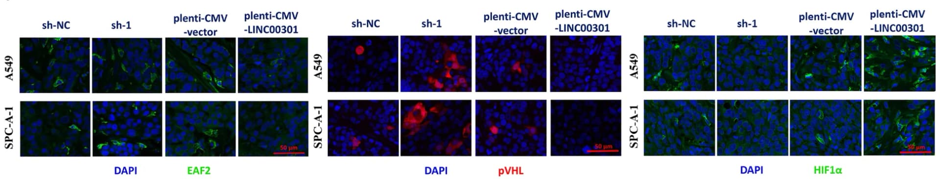 Open access visualization of Microscopy, Immunohistochemistry, PD-L1 Expression, Lung Adenocarcinoma, Normal Tissue