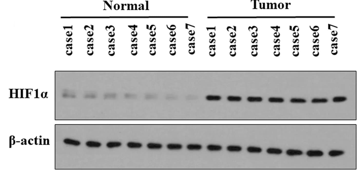 Open access visualization of Gel, CXCL12, ID3, AML Cells, OCI-AML3 Cells