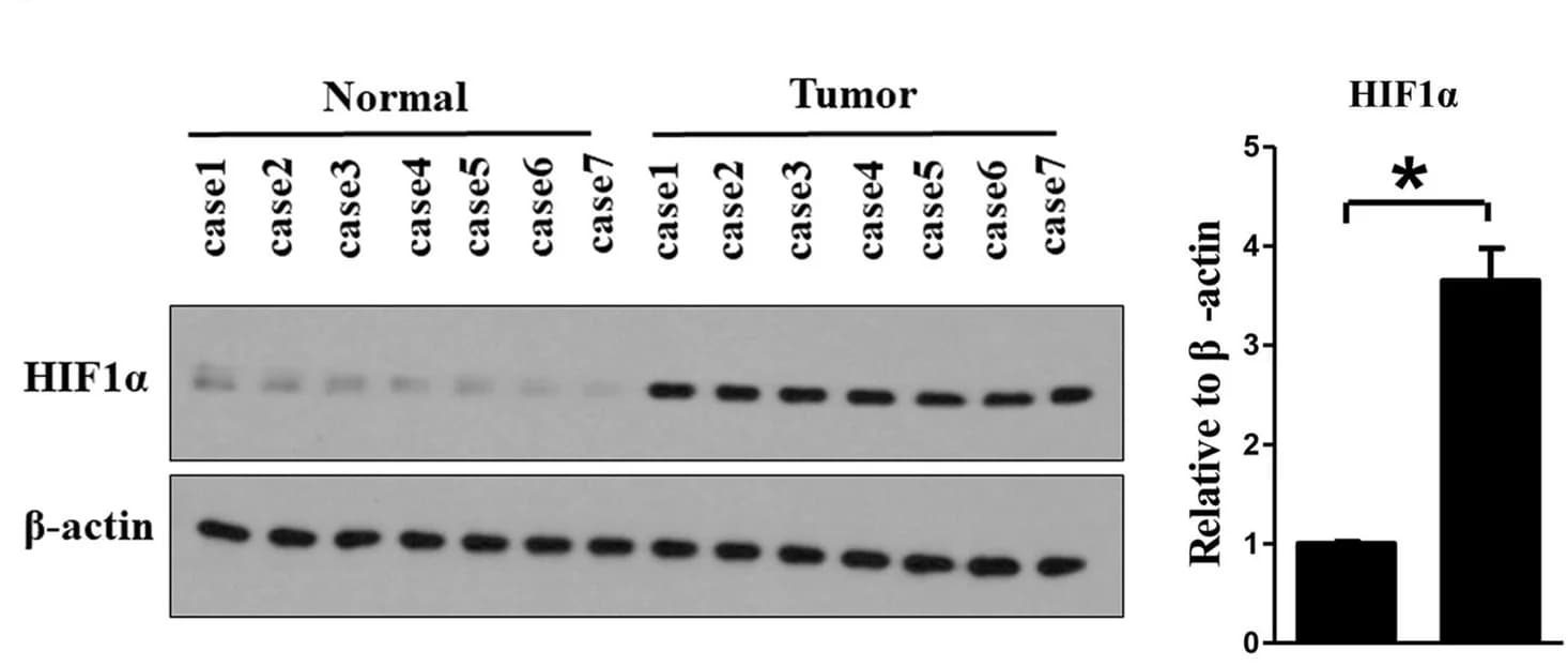 Open access visualization of Bar Plot, Error Bars, Gel, H&E Staining, Lung Tissues