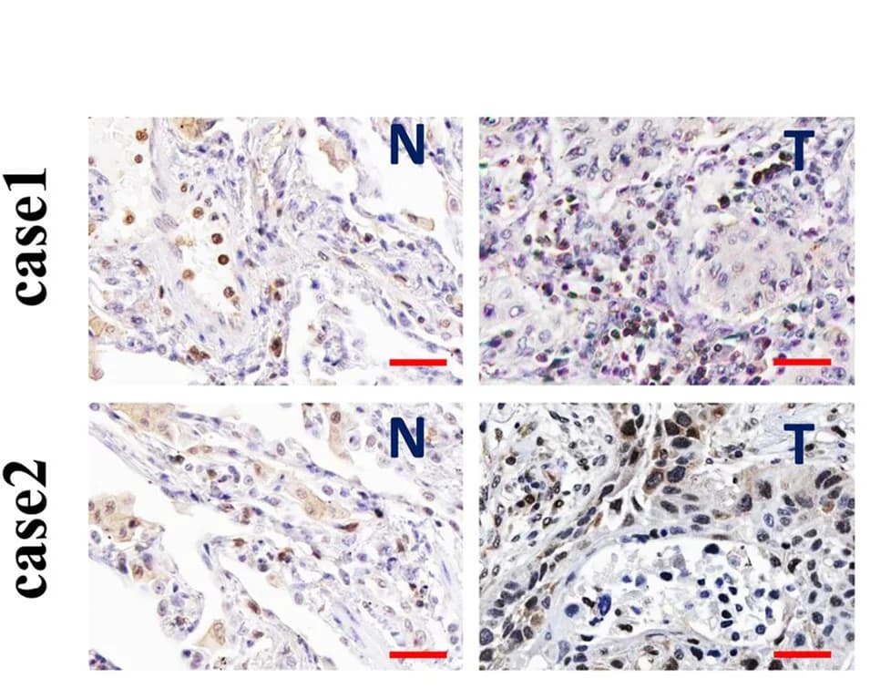 Open access visualization of Microscopy, Fibrotic Area, Lung Tissues, Quantitative Analysis, ANOVA