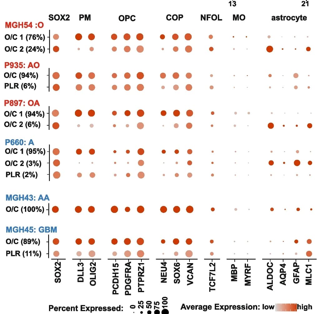Open access visualization of Bubble Plot, SOX2, Oligodendrocytic lineage markers, Astrocytic lineage markers, PM glioma samples