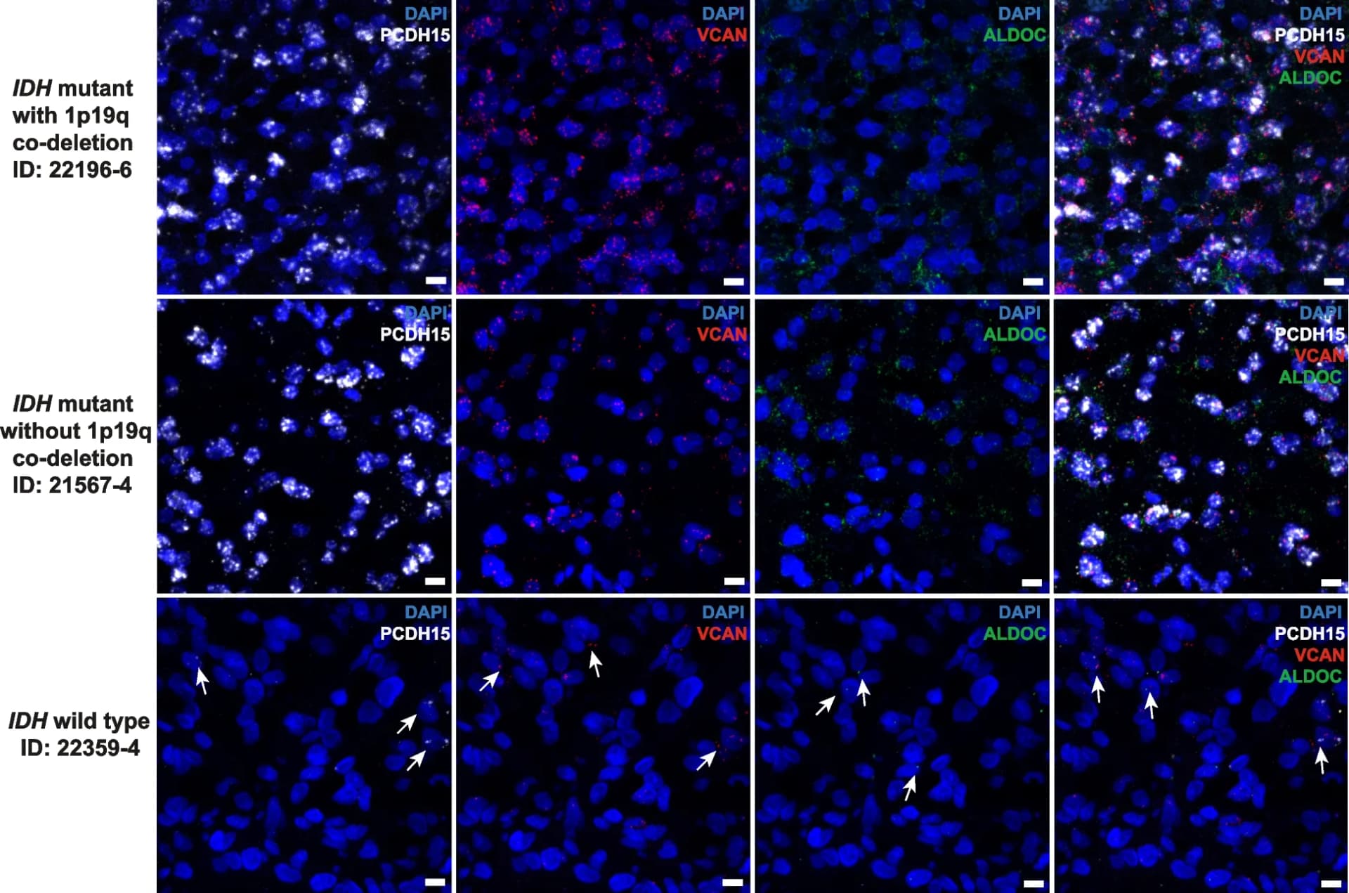 Open access visualization of Microscopy, OPC, COP, RNAscope, IDH-mutant/PM Gliomas
