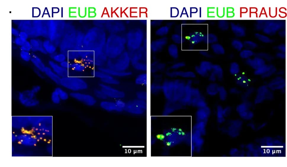 Open access visualization of Microscopy, FISH Images, Akkermansia Muciniphila, Faecalibacterium Prausnitzii, Glioblastoma Multiforme