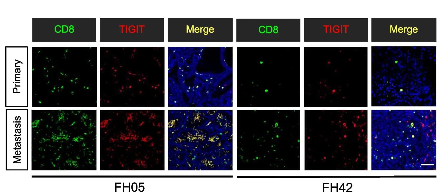 Open access visualization of Microscopy, CD8, TIGIT, Immunofluorescence Staining, Protein Expression