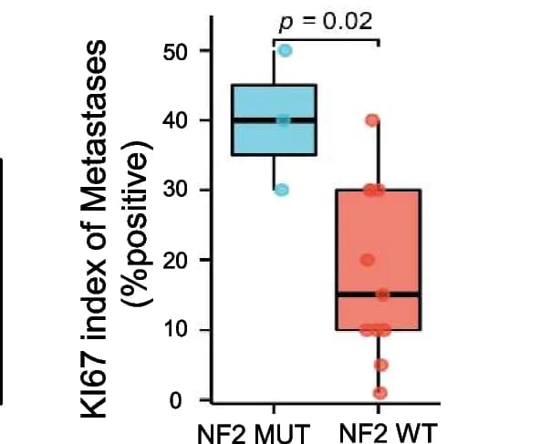 Open access visualization of Box Plot, Scatter Plot, KI67 Staining, NF2 Mutation, Metastatic Lesions