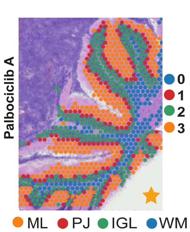 Open access visualization of Microscopy, Scatter Plot, Mouse Spots, Cerebellum Regions, PDOX Sections