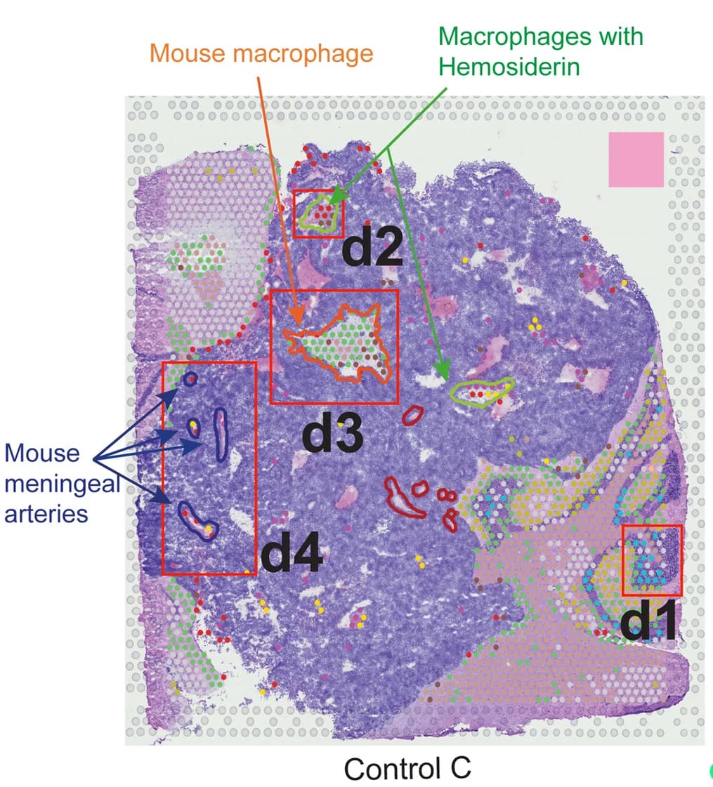 Open access visualization of Microscopy, Cell Types, Reference-Based Annotation, Pathological Annotation, H&E Sections