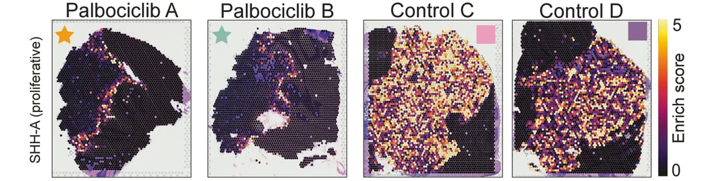 Open access visualization of Heatmap, SHH-A Gene Signature, Cell Cycle, Palbociclib, Control Samples