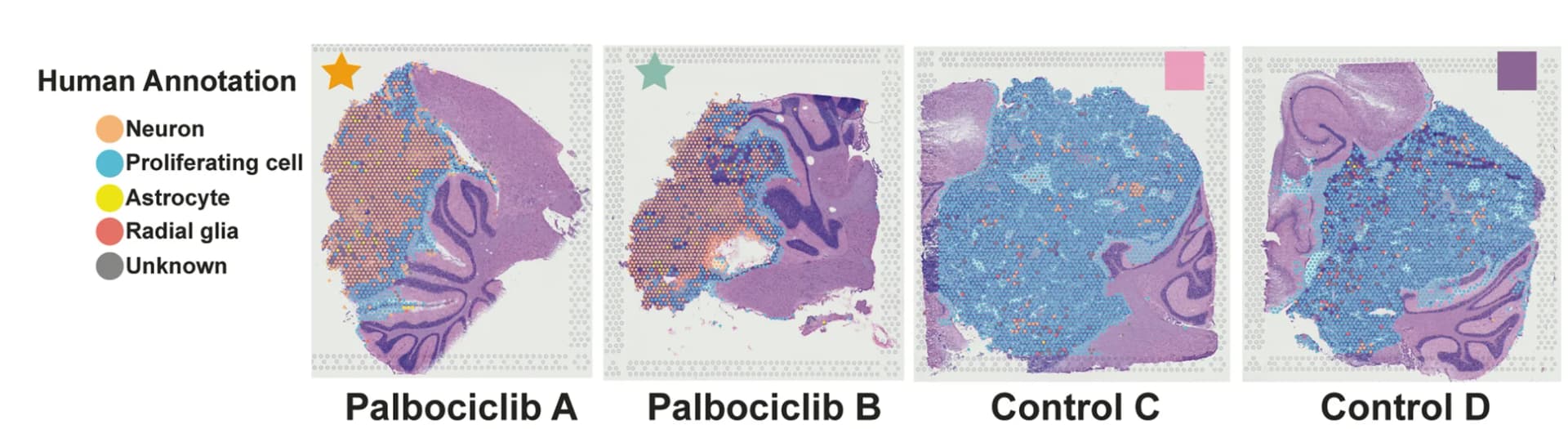 Open access visualization of Microscopy, Automated Annotation, Human/Mix Spots, scRNA-seq Dataset, Fetal Human Brain