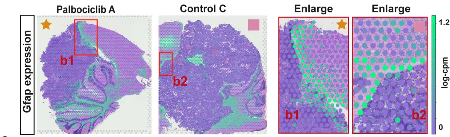 Open access visualization of Microscopy, Astrocytes, Gfap, Gene Expression, Interface Region