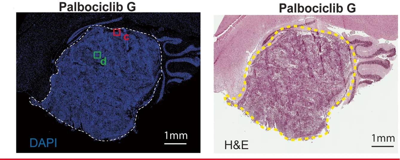 Open access visualization of Microscopy, DAPI, H&E Image, Drug-treated Tumour, Palbociclib