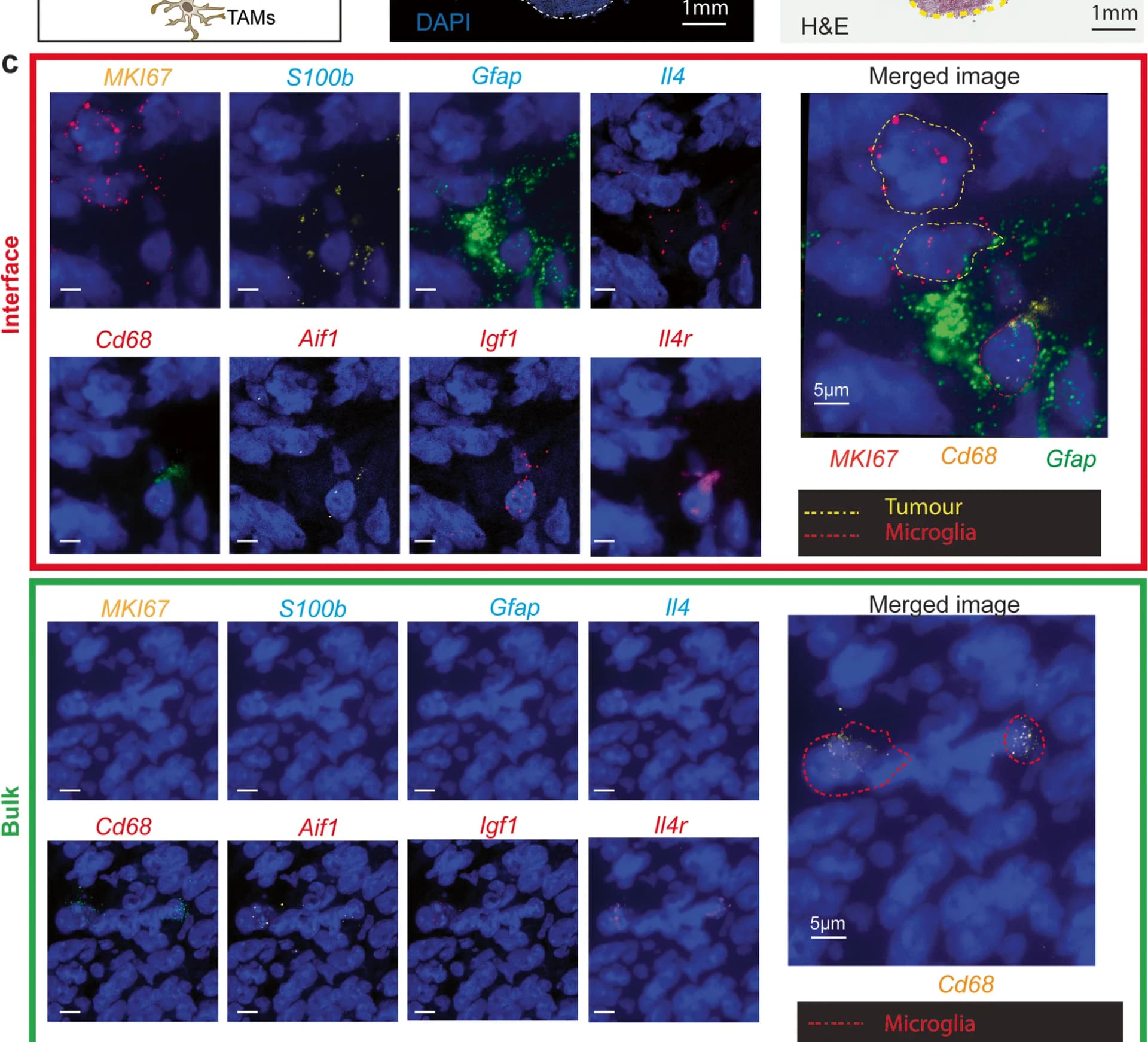 Open access visualization of Microscopy, Tumor Bulk, Granule Neuron Progenitors, Tumor-Associated Microglia