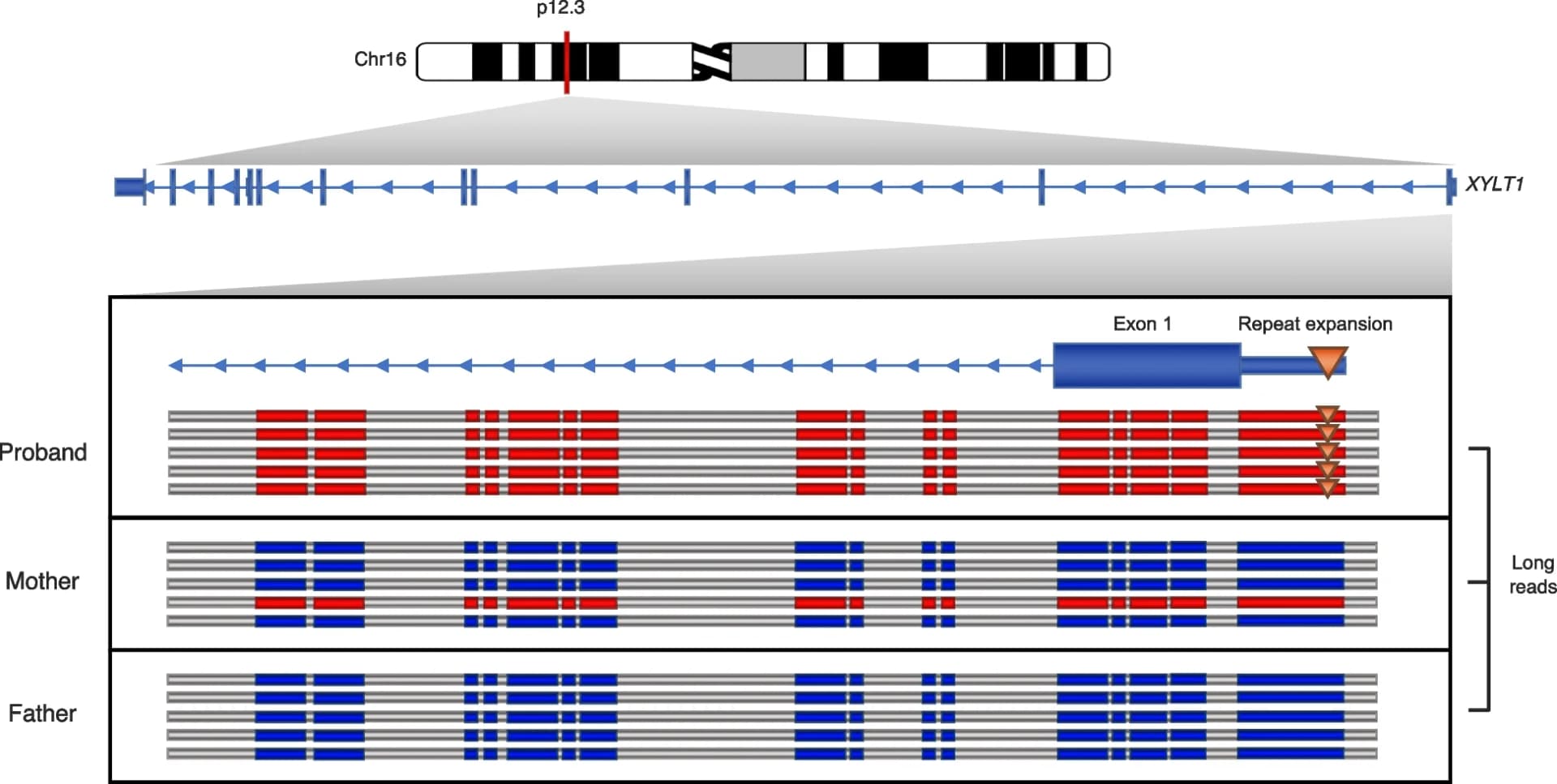 Open access visualization of Illustration, Workflow, GGC Repeat Expansion, Untranslated Region, XYLT1