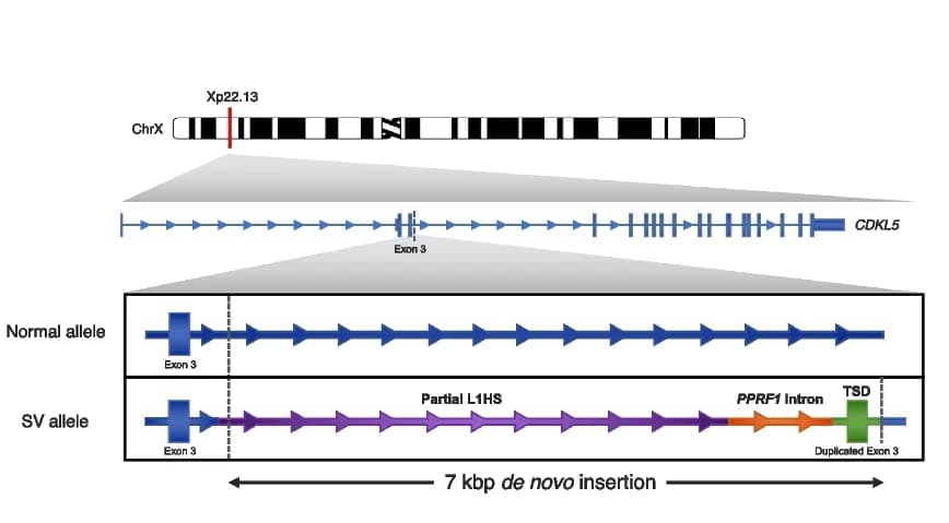 Open access visualization of Illustration, De Novo Insertion, CDKL5 Exon 3, Intellectual Disability