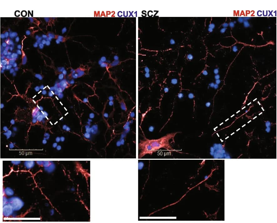 Open access visualization of Microscopy, Dendritic Spines, SCZ Neurons, CON Neurons, CUX1