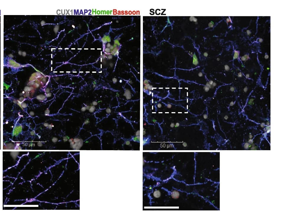 Open access visualization of Microscopy, Synaptic Puncta, SCZ Neurons, CON Neurons, CUX1
