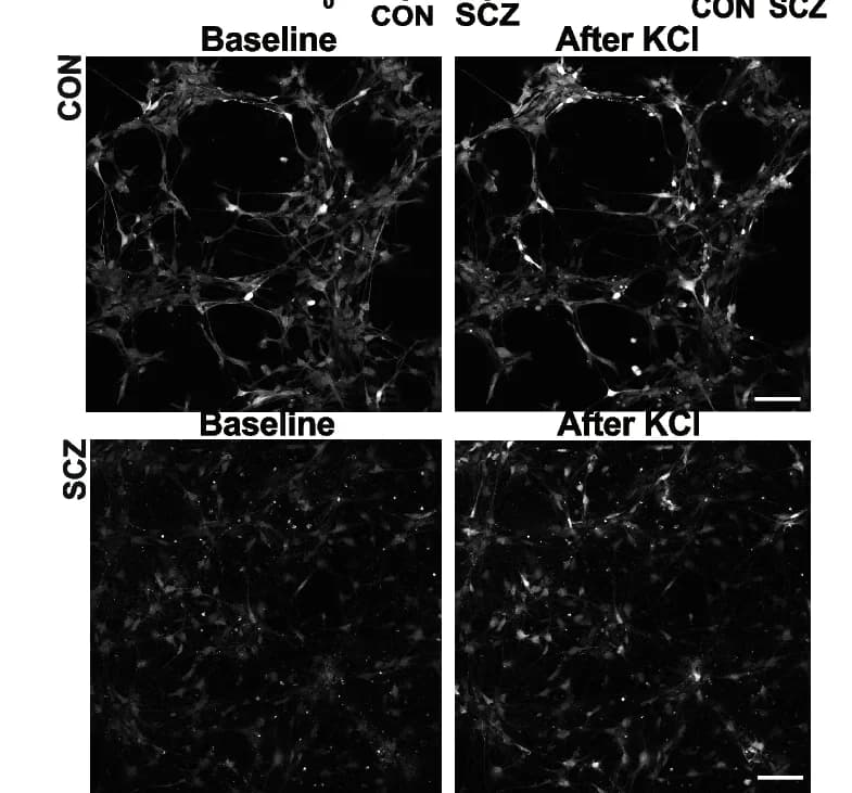 Open access visualization of Microscopy, Calcium Imaging, CON Neurons, SCZ Neurons, Potassium Chloride