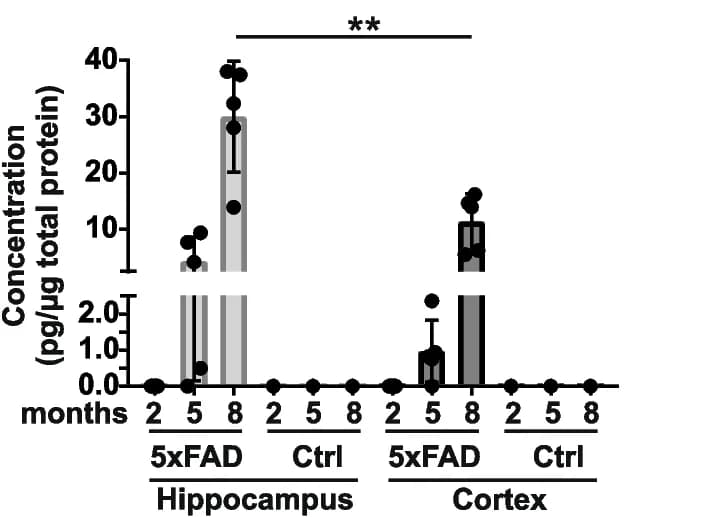Open access visualization of Bar Plot, Error Bars, Hippocampus, Cortex, Brain Extracts
