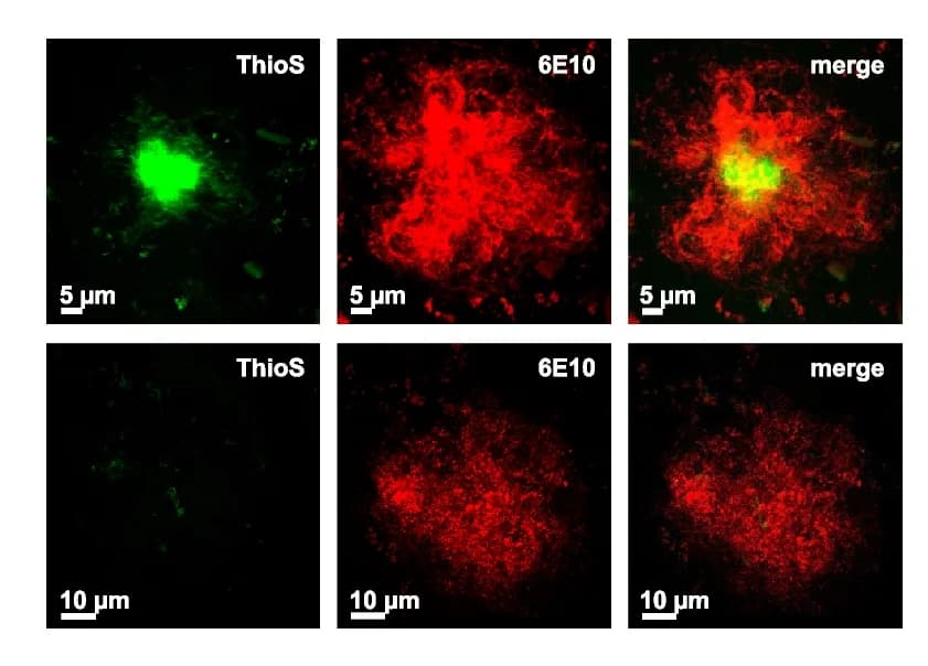 Open access visualization of Microscopy, Immunofluorescence, Dense Core Plaques, Diffuse Plaques, Brain Slice