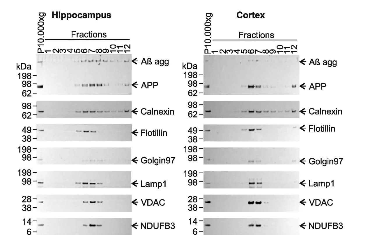 Open access visualization of Gel, Fractionation, Hippocampus, Cortex, Brain Extracts