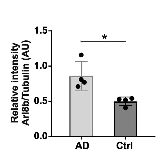 Open access visualization of Bar Plot, Error Bars, Arl8b expression, Tubulin, Immunoblots