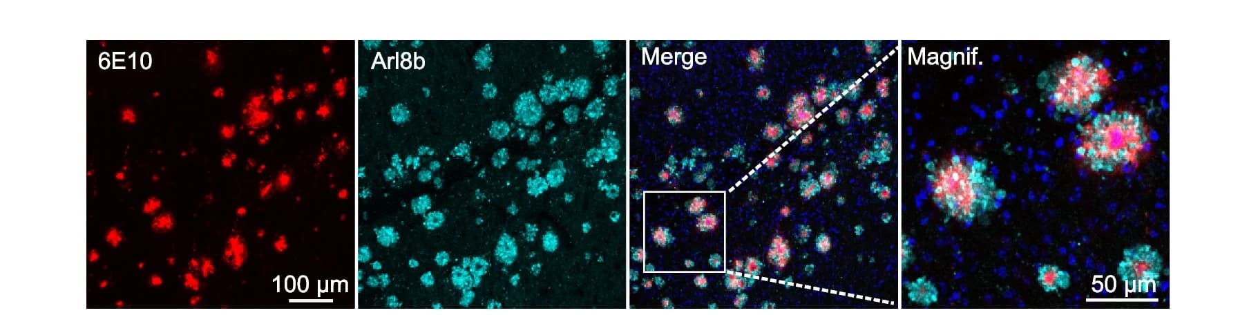 Open access visualization of Microscopy, Immunofluorescence analysis, 5xFAD mouse, Brain slices, 6E10 antibody