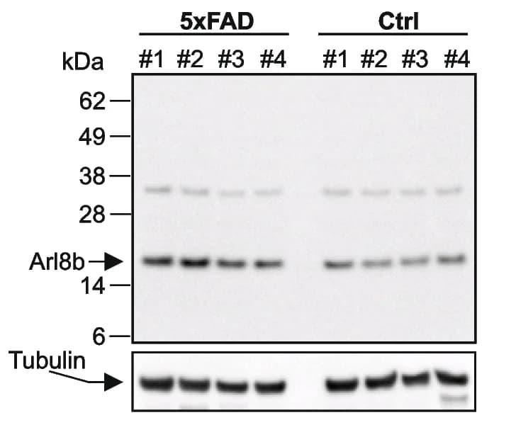 Open access visualization of Gel, Brain slices, 5xFAD mice, 352 antibody, Lamp1 antibodies