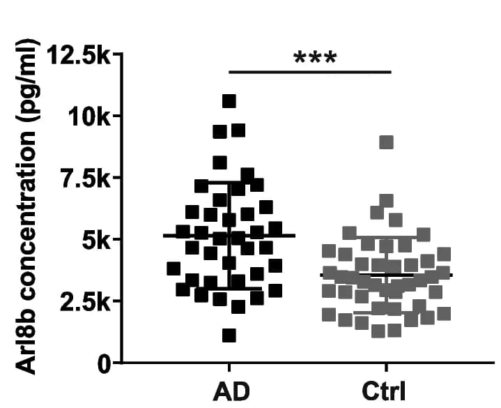 Open access visualization of Scatter Plot, Arl8b Concentrations, CSF Samples, AD Patients, Control