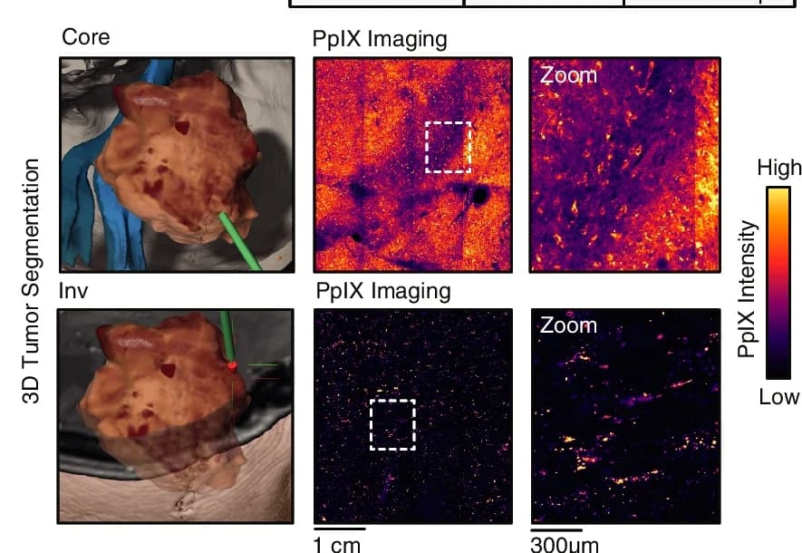 Open access visualization of Microscopy, 3D Plot, Photo, Two-Photon Excitation Fluorescence, PpIX