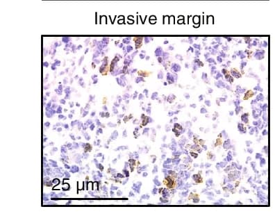Open access visualization of Microscopy, Ki67 Immunohistochemistry, Invasive Margin, Proliferating Cells, GBM
