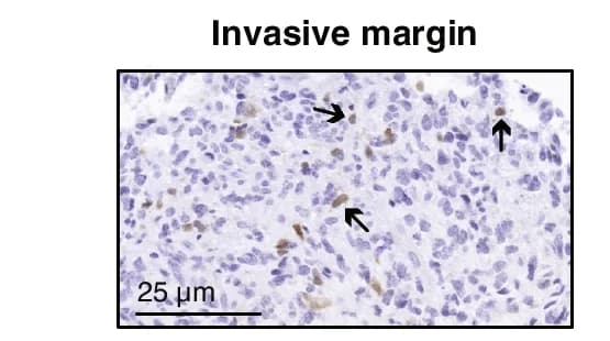 Open access visualization of Microscopy, NeuN Immunohistochemistry, Invasive Margin, Neuronal Cells