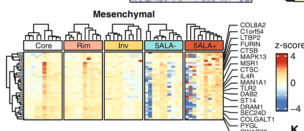 Open access visualization of Heatmap, Clustered, Gene Expression, GBM Subtypes, Mesenchymal