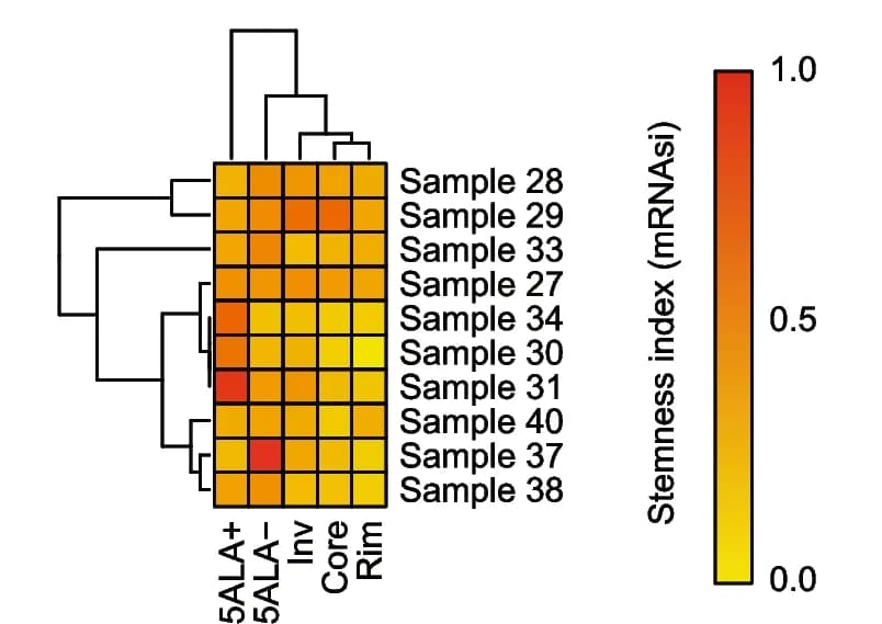 Open access visualization of Heatmap, Clustered, mRNA stemness index, GBM regions, Clustering