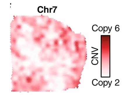 Open access visualization of Heatmap, CNV analysis, Chromosomes, Spatial surface plot