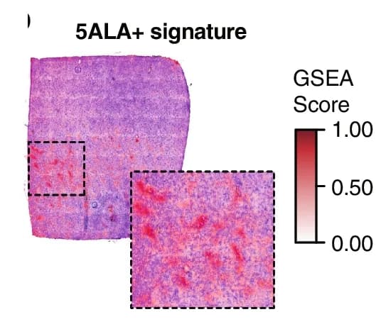 Open access visualization of Microscopy, GSEA score, Spatial arrangement, Gene signature, Enriched spots
