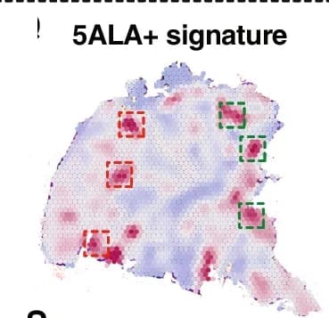 Open access visualization of Geo Map, Spatial locations, Enriched spots, GSEA score, Gene signature