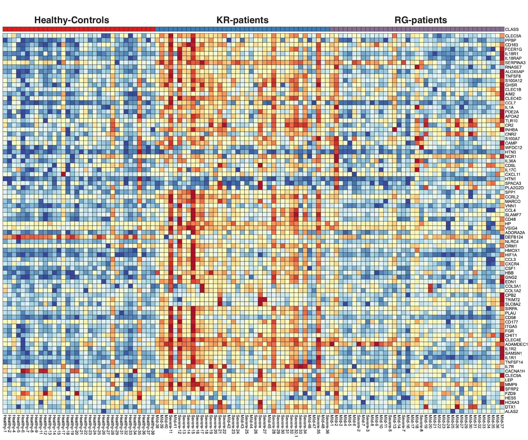 Open access visualization of Heatmap, Clustered, Normalized Expression, Differentially Expressed Genes, KR-Patients