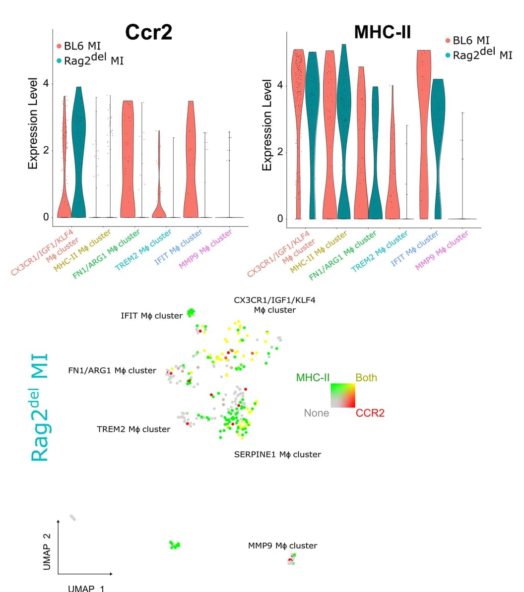 Open access visualization of Violin Plot, Scatter Plot, UMAP, Violin Plots, CCR2 Expression