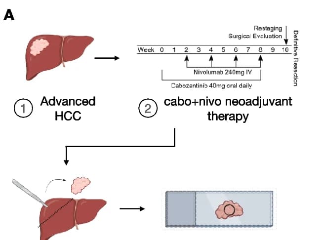 Open access visualization of Workflow, Illustration, Hematoxylin and Eosin Staining, Spatial Clusters, Responders
