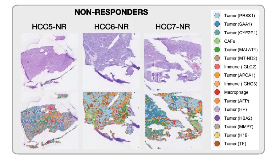 Open access visualization of Microscopy, Hematoxylin and Eosin Staining, Spatial Clusters, Non-Responders