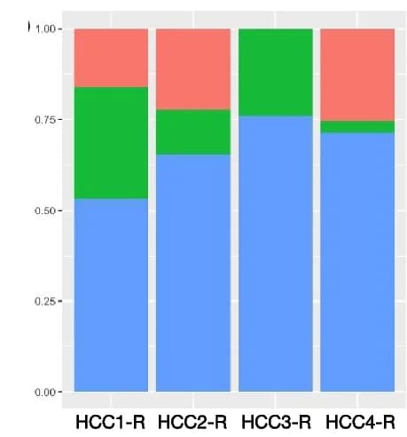 Open access visualization of Stacked Bar Plot, Tumor Cells, Immune Cells, Cancer-Associated Fibroblasts, Spatial Transcriptomics