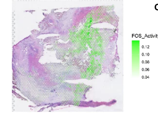 Open access visualization of Microscopy, Heatmap, HCC, CAF, FOS Network