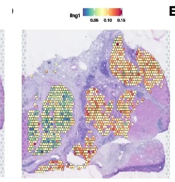 Open access visualization of Microscopy, Immune-related Pathways, Immune-rich Region, Responders