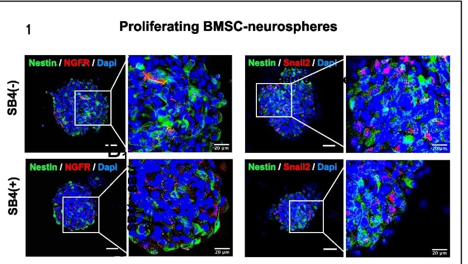 Open access visualization of Microscopy, Immunocytochemistry, BMSC-Derived Neurospheres, Neural Crest Marker, Neural Markers