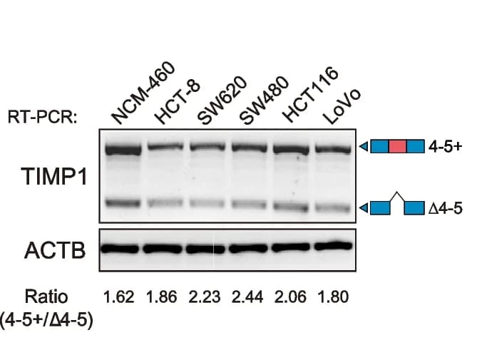 Open access visualization of Gel, RT-PCR, TIMP1, CRC Cancer Cell Lines, Normal Colon Mucosal Epithelial Cell Line