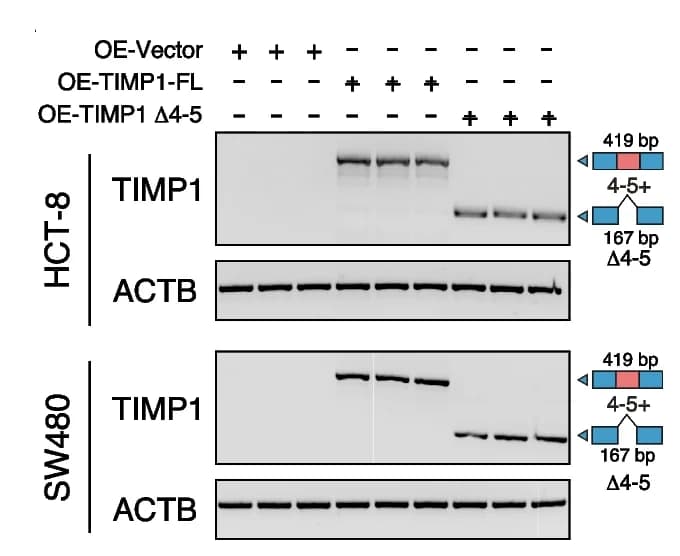 Open access visualization of Gel, TIMP1, Overexpression, HCT-8 Cells, SW480 Cells