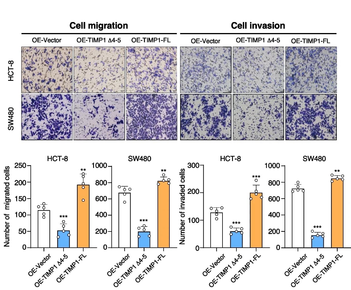Open access visualization of Bar Plot, Error Bars, Microscopy, Tumor Cell Migration, Invasion Assay