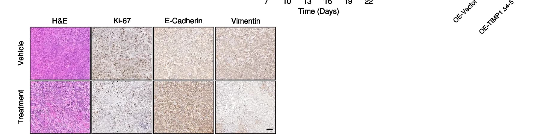 Open access visualization of Microscopy, H&E Staining, IHC, Tumors