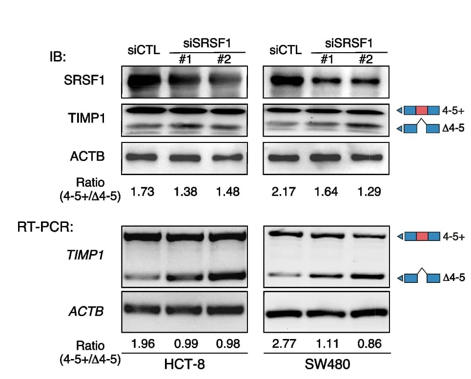 Open access visualization of Gel, Western Blot, RT-PCR, TIMP1 Exon Skipping, si-SRSF1