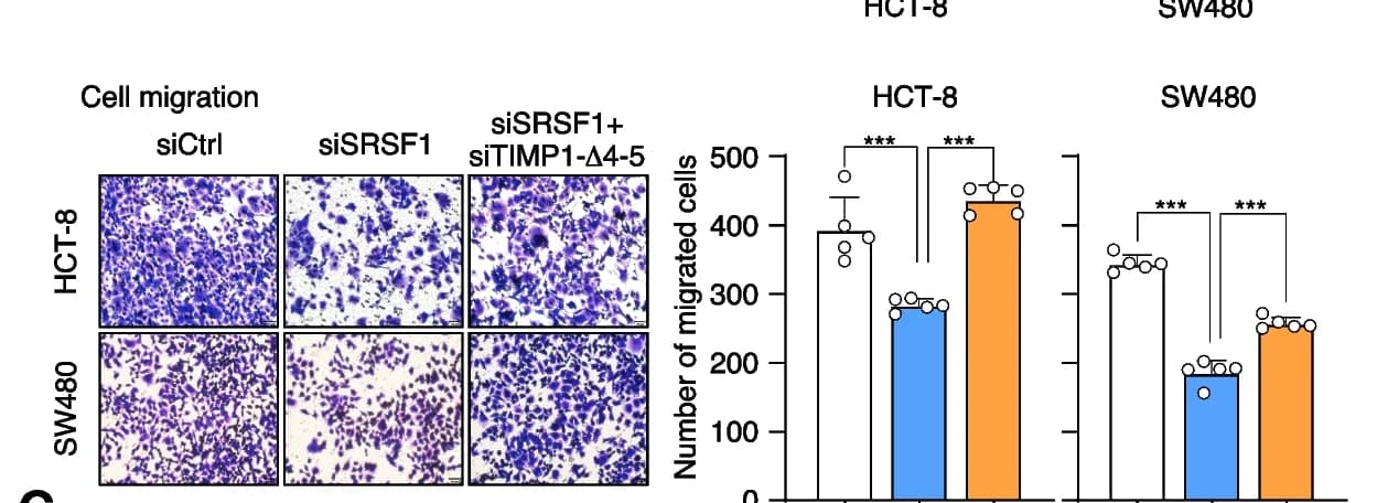 Open access visualization of Bar Plot, Photo, Microscopy, Tumor Cell Migration, HCT-8 Cells